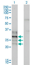 NFATC2IP Antibody (monoclonal) (M01)