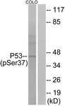 p53 (Phospho-Ser37) antibody
