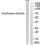 Tau (Phospho-Ser235) antibody
