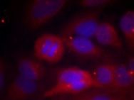 Tyrosine Hydroxylase (phospho Ser40) Antibody