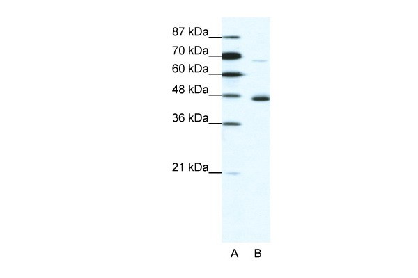 NEUROD1 antibody - N-terminal region