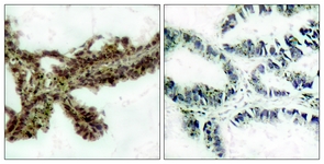 Akt (Phospho-Thr308) antibody