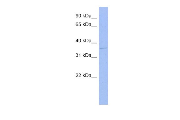 TLX3 antibody