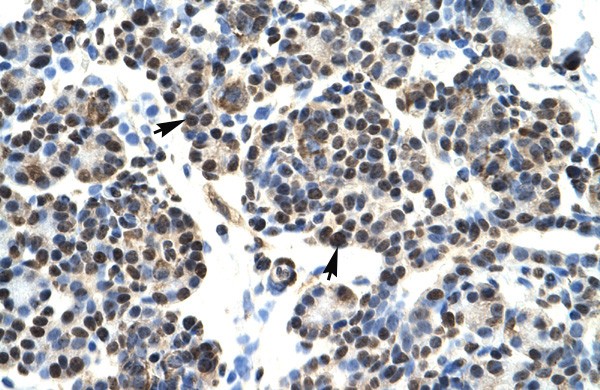 HOXB5 antibody - N-terminal region