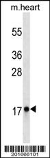 Myoglobin Antibody (Ascites)