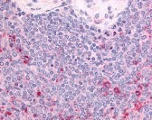 KIT Oncogene Antibody