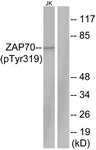 ZAP-70 (Phospho-Tyr319) antibody