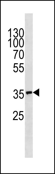 NFKBIA Antibody