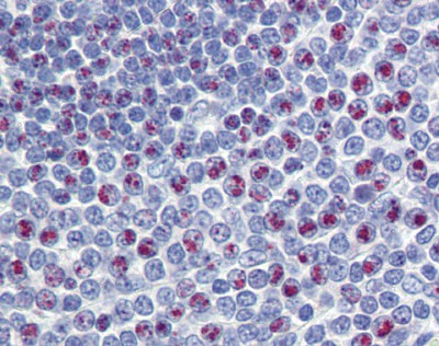 FOXM1 antibody