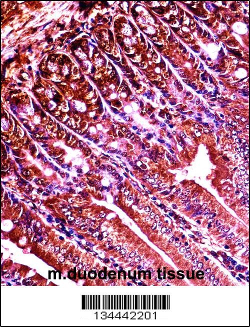 Mouse Abl1 Antibody