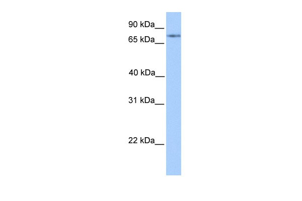 FOXO1 antibody - C-terminal region