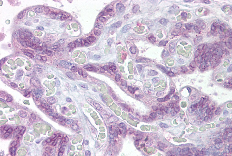 IRF6 antibody - middle region