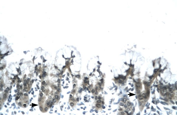 ACDC Antibody