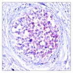 C-RAF (Phospho-Ser259) antibody
