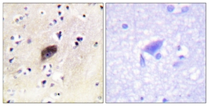 PAK1/2/3 (Phospho-Ser144/141/139) antibody