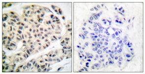 MEF2A (Phospho-Thr319) antibody