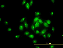 MGC16169 Antibody (monoclonal) (M01)