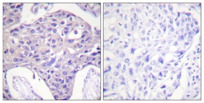 FOXO1/3/4-pan antibody