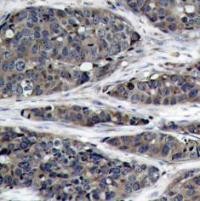 NFkB p105 / p50 Antibody