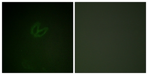 SYK (Phospho-Tyr323) antibody