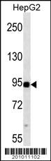 MAP3K11 Antibody (ascites)