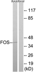 FOS antibody