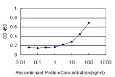 ME1 Antibody (monoclonal) (M02)