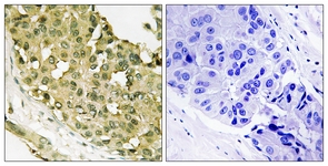 STMN1 (Phospho-Ser62) antibody