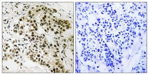 Retinoblastoma antibody