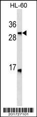 LTB Antibody (C-term)(Ascites)