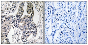Vimentin (Phospho-Ser83) antibody