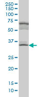 MYOZ1 Antibody (monoclonal) (M05)