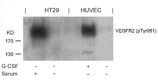 VEGFR2 (phospho Tyr951) Antibody