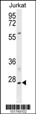 NPM1 Antibody