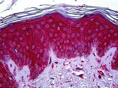 KIT Antibody