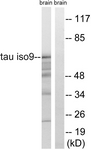 Rabbit anti-Tau antibody