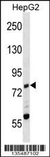 Mouse Zap70 Antibody