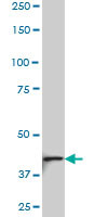 NDST3 Antibody (monoclonal) (M01)