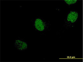 NEUROG1 Antibody (monoclonal) (M06)