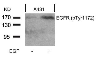 EGFR (phospho Tyr1172) Antibody