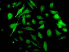 NME2 Antibody (monoclonal) (M11)