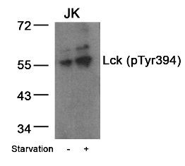 Lck (phospho Tyr394) Antibody