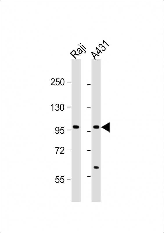 NFKB1 Antibody