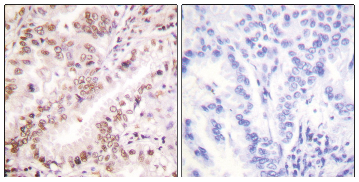 Estrogen Receptor-alpha (phospho Tyr537) Antibody