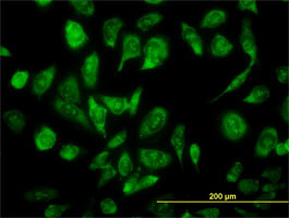 NCOA4 Antibody (monoclonal) (M05)