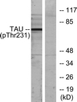 Tau (Phospho-Thr231) antibody