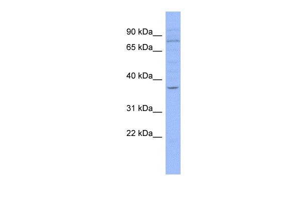 HIC1 antibody - N-terminal region