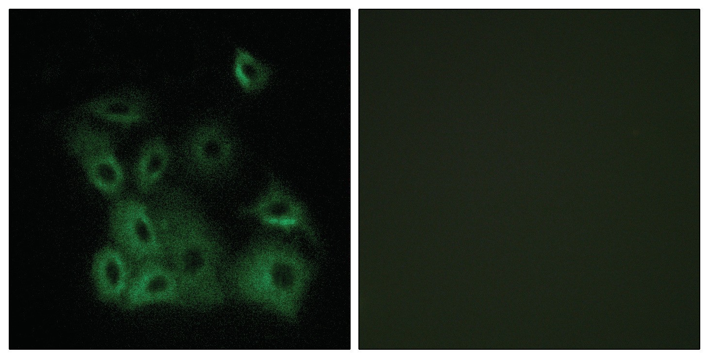 Bax (phospho Thr167) Antibody
