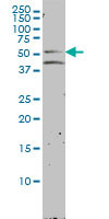 NR1H2 Antibody (monoclonal) (M01)