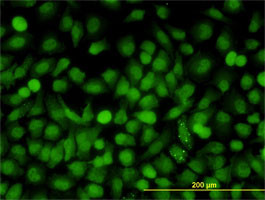 MAPK9 Antibody (monoclonal) (M03)